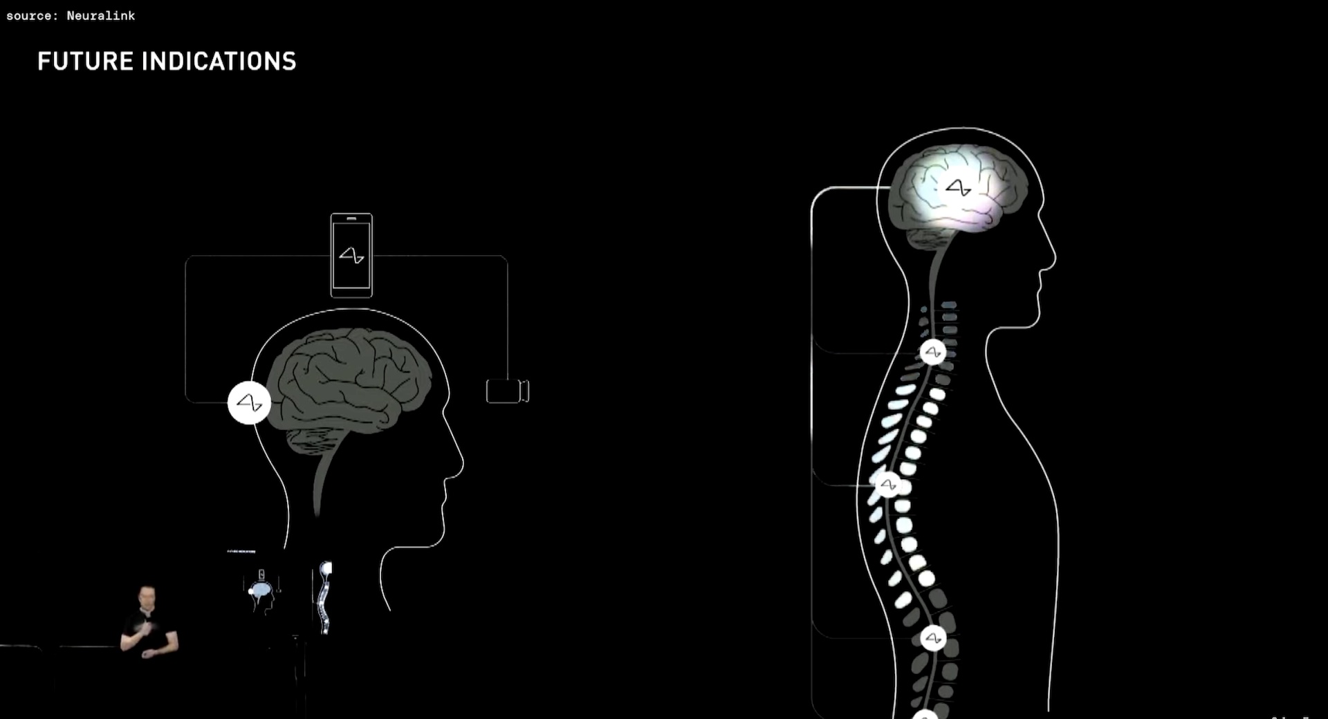 SCIENCES Des chercheurs ont reproduit les connexions du cerveau humain. Le  petit robot qui comprend ce qu'on lui dit