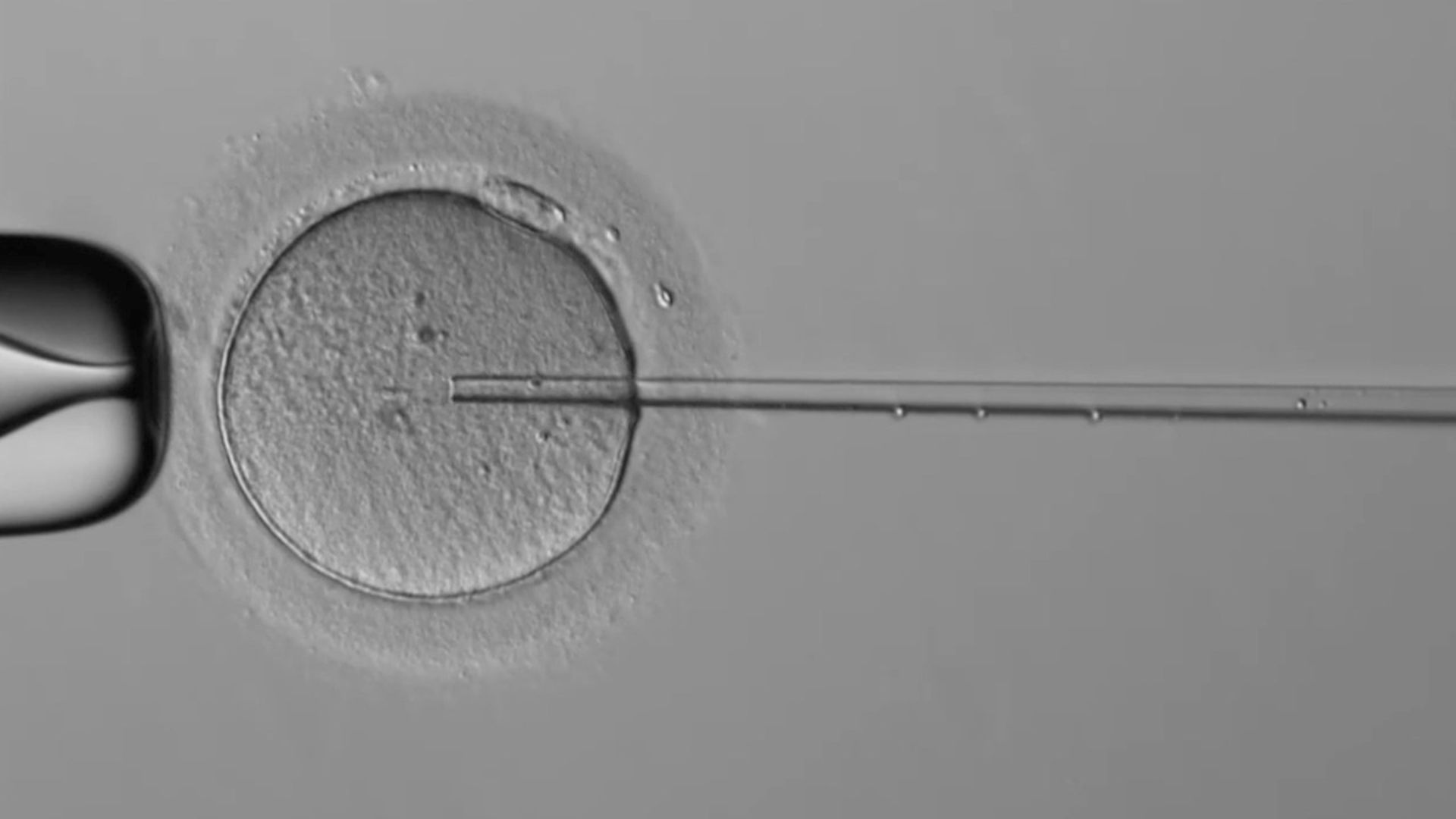 Une manette de PS5 pour féconder un ovule : cette première dans la médecine  a donné naissance à 2 bébés - Numerama